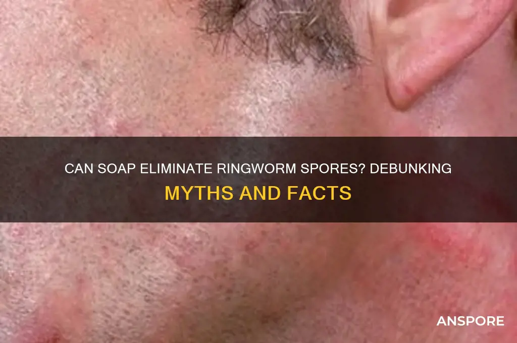 does soap kill ringworm spores