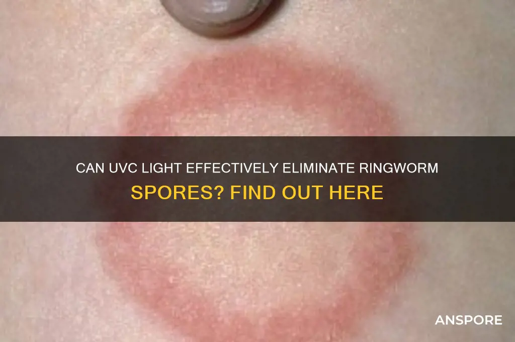 does uvc kill ringworm spores
