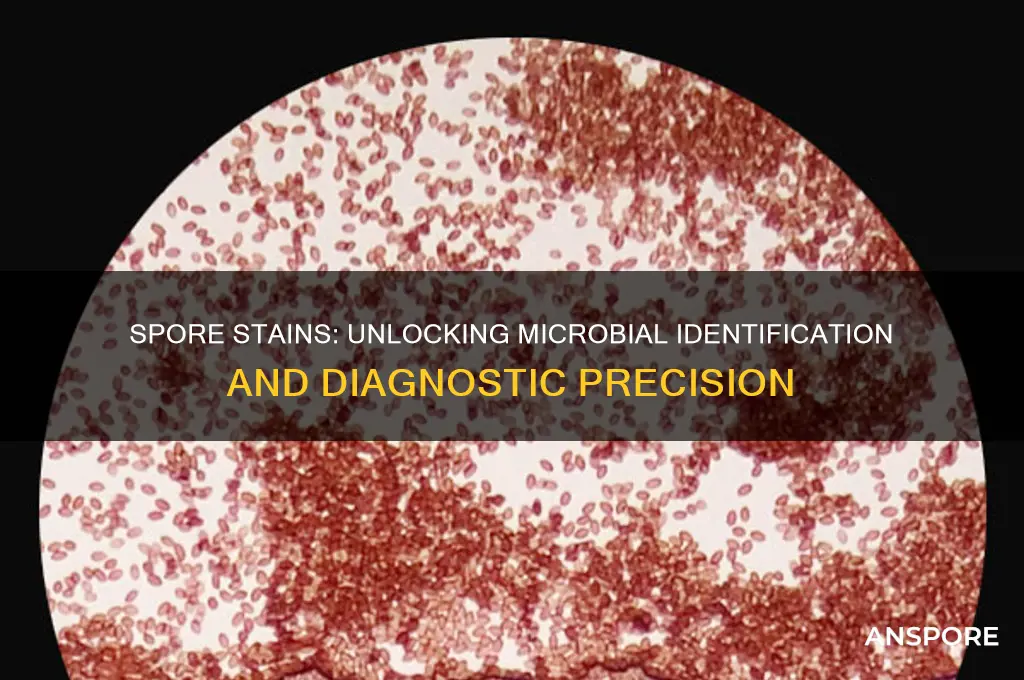 how are spore stains useful