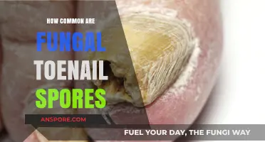 Understanding Fungal Toenail Spores: Prevalence and Common Concerns Explained