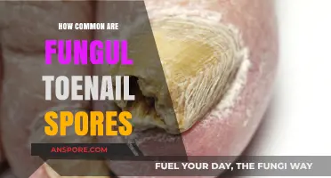Understanding Fungal Toenail Spores: Prevalence and Common Occurrence Explained