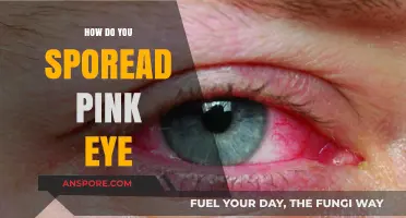 How Pink Eye Spreads: Causes, Prevention, and Quick Remedies