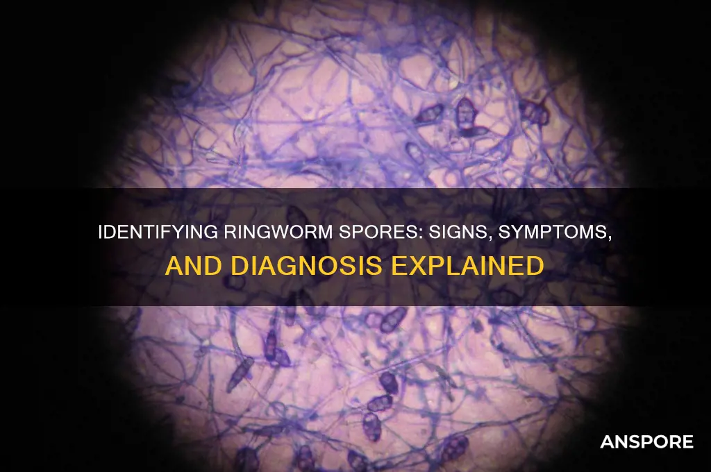 how do yoy knkw if you have ringworm spores