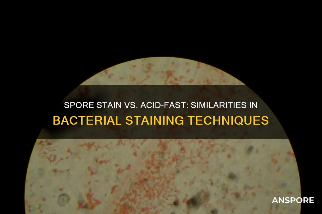 how does the spore stain resemble the acid fast stain