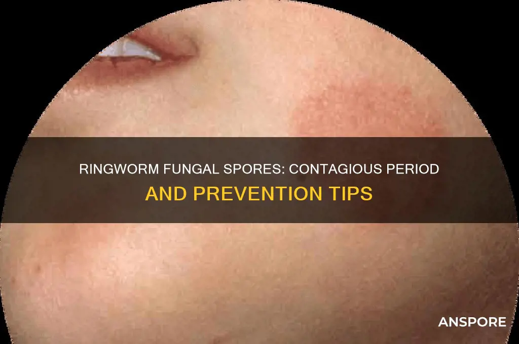 how long are ringworm fungal spores contagious