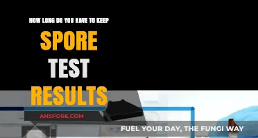 Spore Test Results Retention: Essential Guidelines for Sterilization Compliance