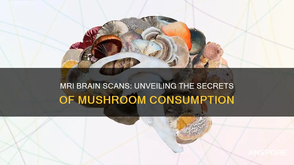 how mushroom brain studies are performed mri