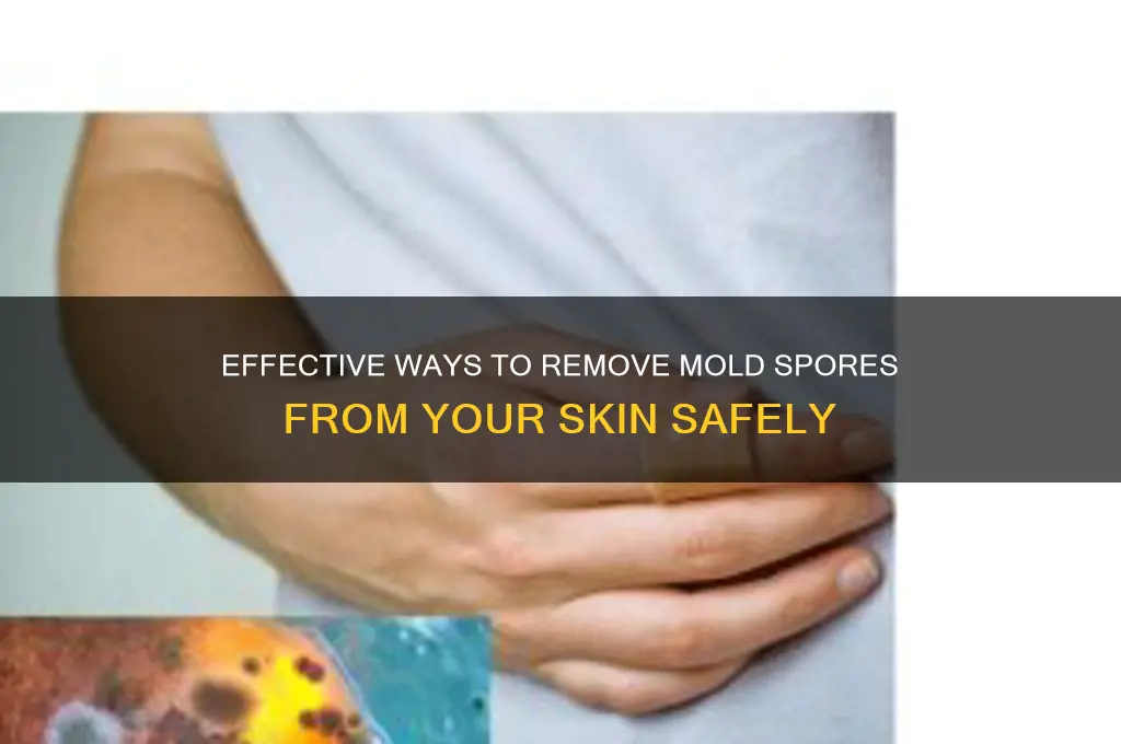 how to get rid of mold spores on skin