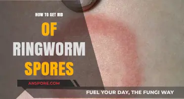 Effective Ways to Eliminate Ringworm Spores and Prevent Recurrence
