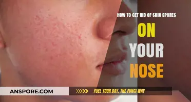 Effective Ways to Eliminate Skin Spores on Your Nose