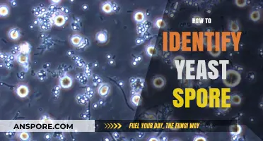 Mastering Yeast Identification: Spotting Spores with Precision and Ease