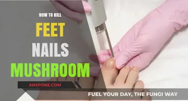 Effective Ways to Eliminate Toenail Fungus and Restore Healthy Feet