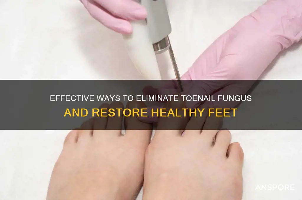 how to kill feet nails mushroom