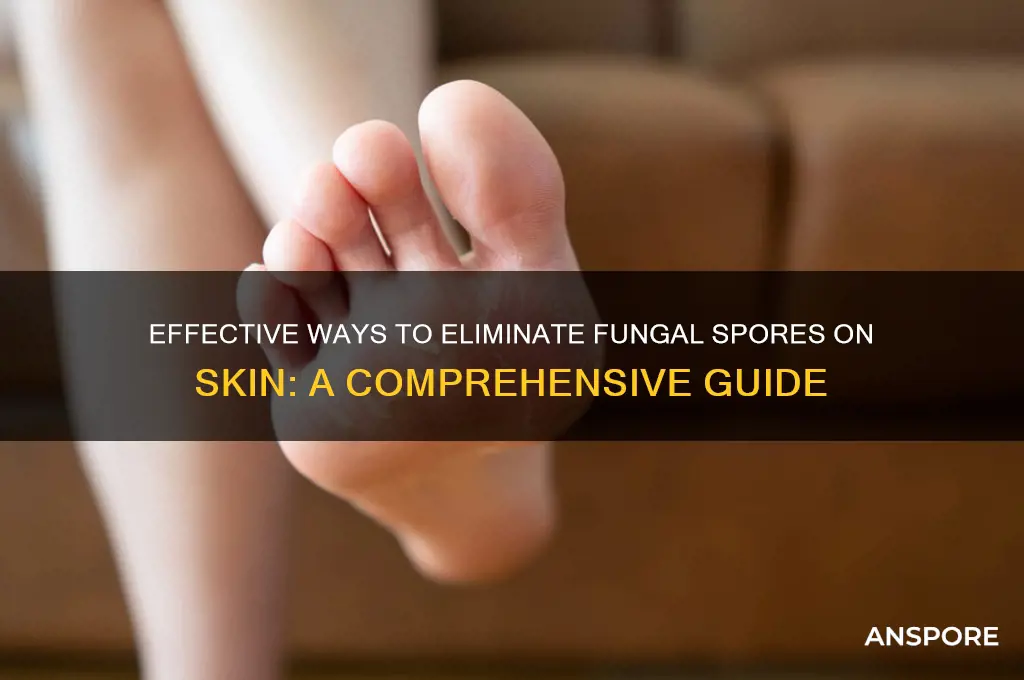 how to kill fungal spores on skin