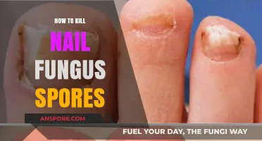 Effective Strategies to Eradicate Nail Fungus Spores Permanently