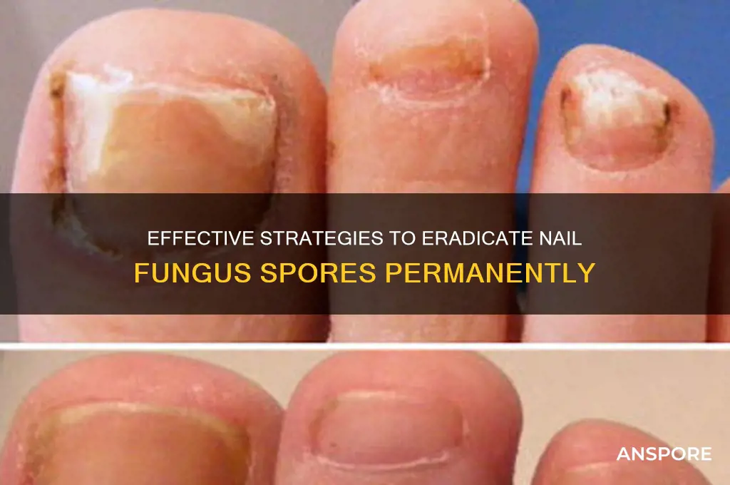 how to kill nail fungus spores