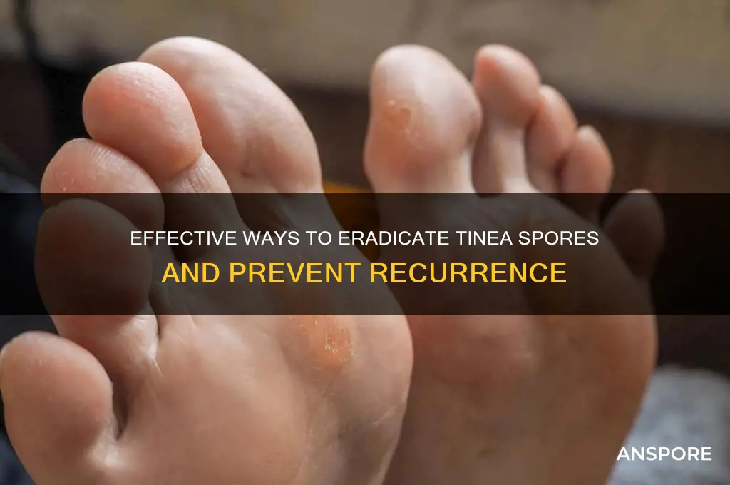 how to kill tinea spores