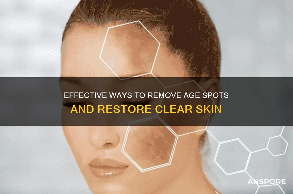 how to remove age spors