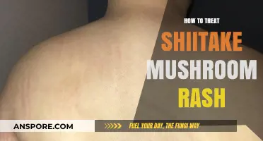 Effective Remedies for Shiitake Mushroom Rash: Relief and Prevention Tips