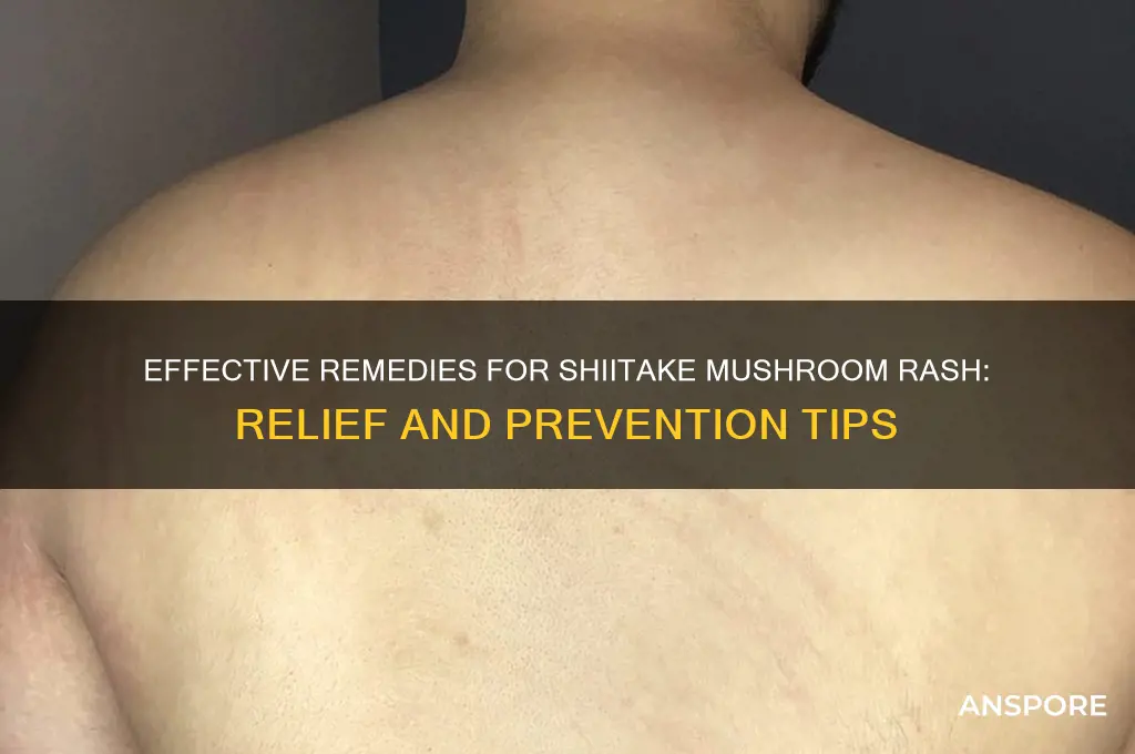 how to treat shiitake mushroom rash