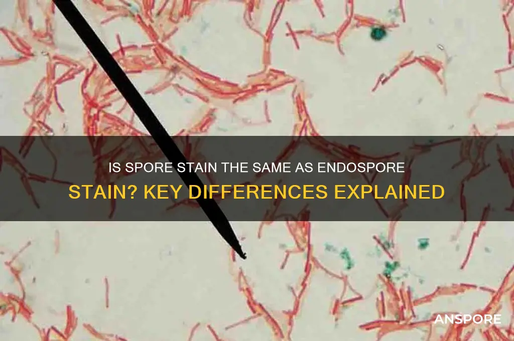 is a spore stain an endospore stain