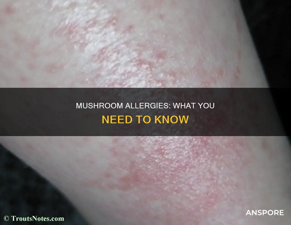 is mushroom an allergen