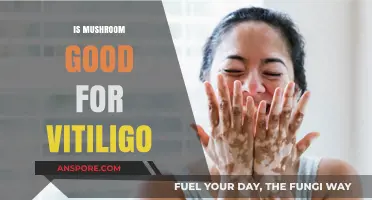 Mushrooms and Vitiligo: Exploring Potential Benefits for Skin Health