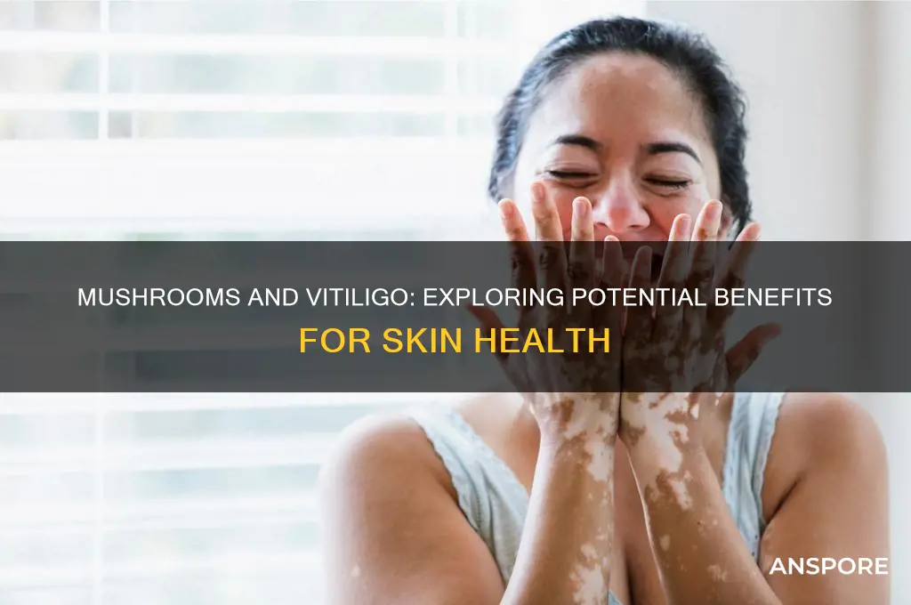 is mushroom good for vitiligo