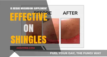 Reishe Mushroom Supplement: Effective Shingles Treatment or Just Hype?