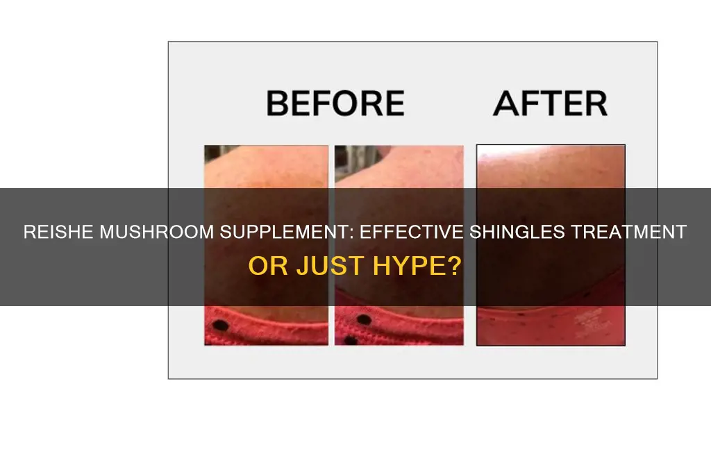 is reishe mushroom supplement effective on shingles
