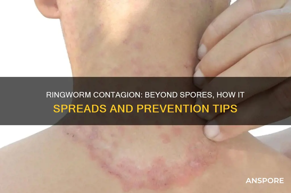 is ringworm only contagious through the spores
