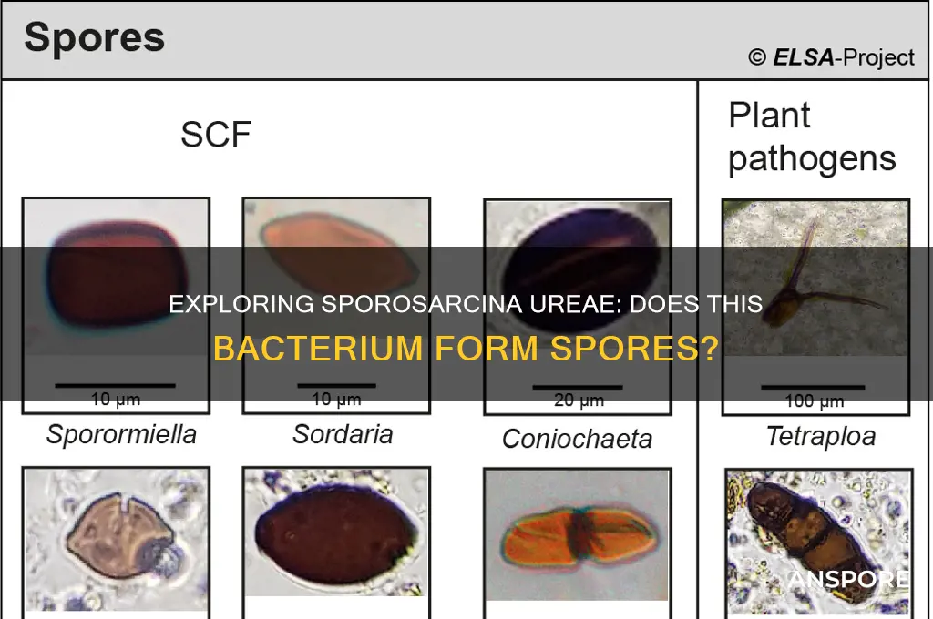 is sporosarcina ureae spore forming