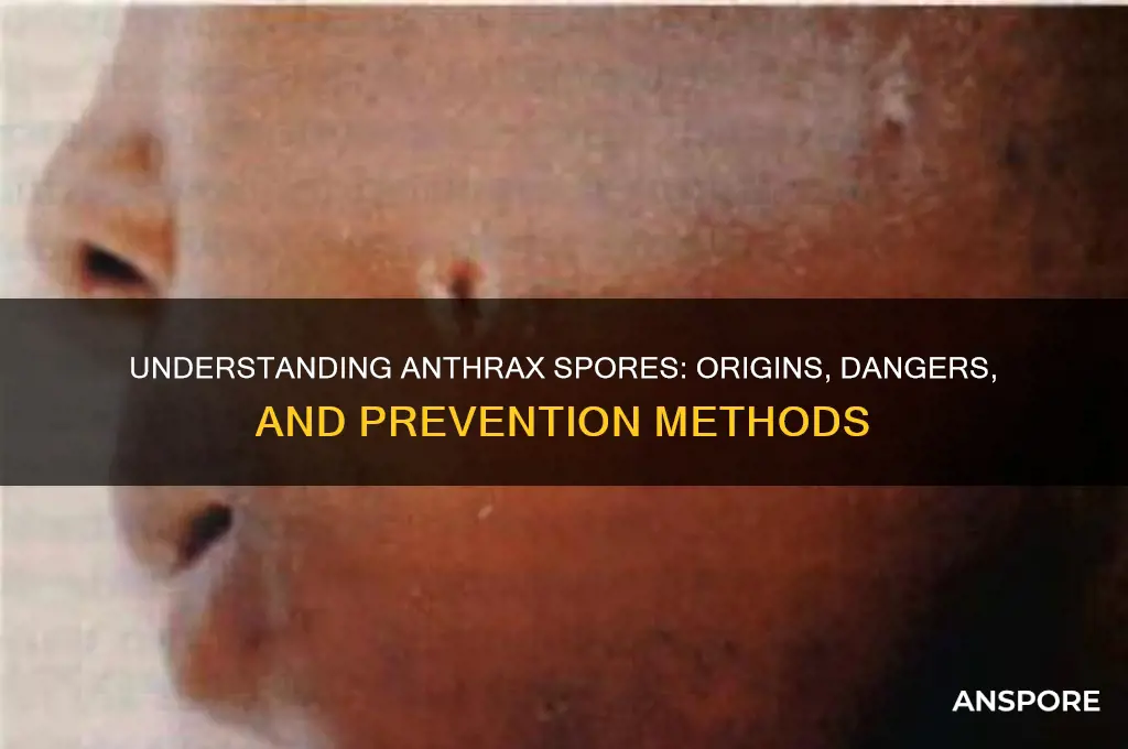 what are anthrax spores