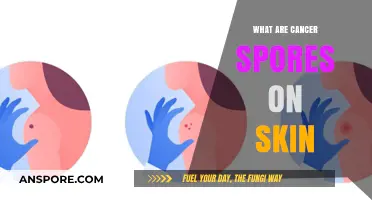 Understanding Cancer Spores on Skin: Causes, Symptoms, and Treatment Options