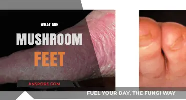 Mushroom Feet: A Strange Skin Condition