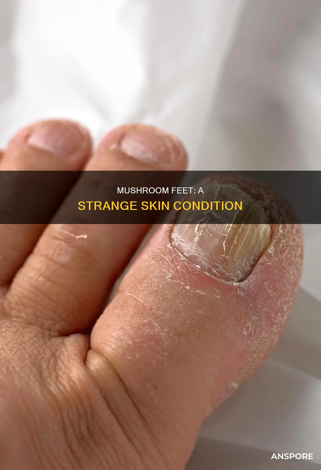 what are mushroom feet