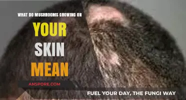 Skin Mushrooms: Causes, Risks, and Treatment for Fungal Skin Growths