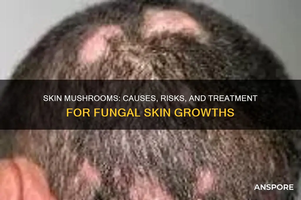 what do mushrooms growing on your skin mean