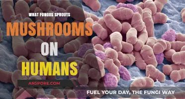 Human Fungal Infections: Understanding Mushrooms Growing on Skin