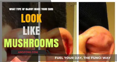 Cauliflower Ear: The Mushroom-Like Injury Explained and Prevented